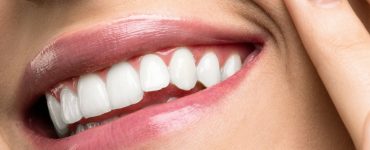 Bis zu 70% weissere Zähne
